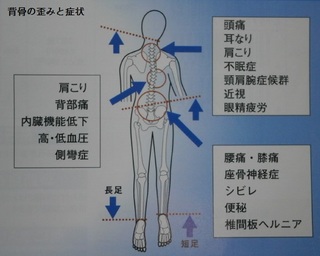 背骨の歪みと症状.jpg