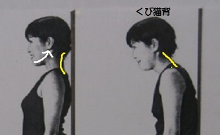 首猫背.jpg